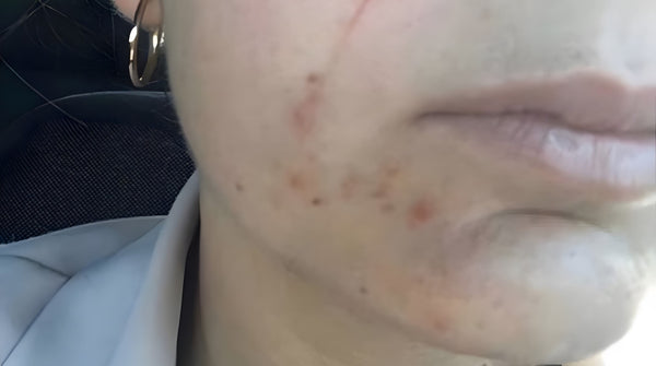 After - Sophie Müller