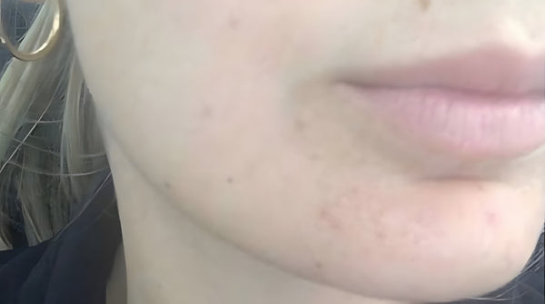 Before - Sophie Müller